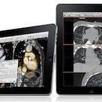 iPad xray images