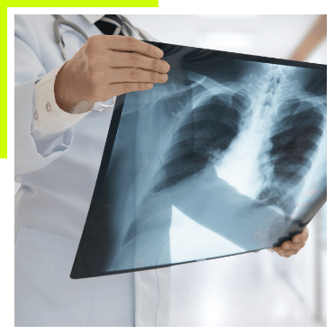 doctor holding xrays